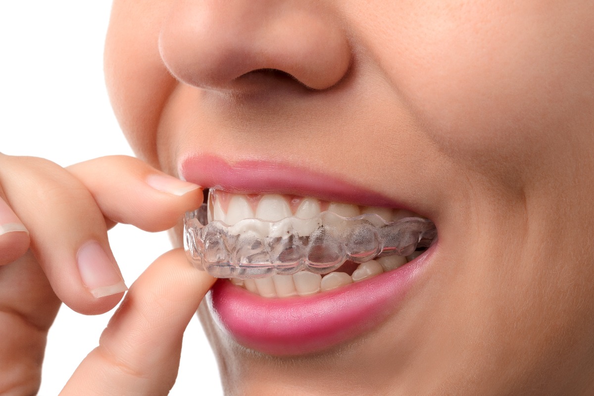 woman wearing invisalign