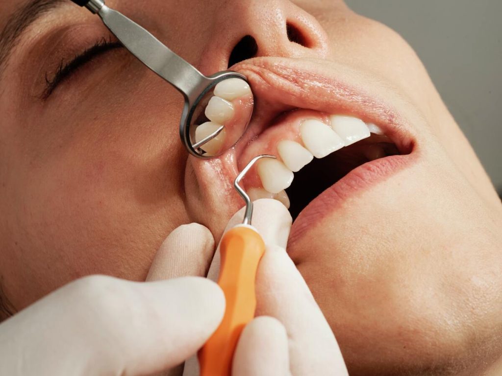 re aligning dental implant