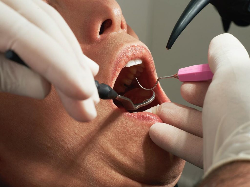 dentist checking patients teeth