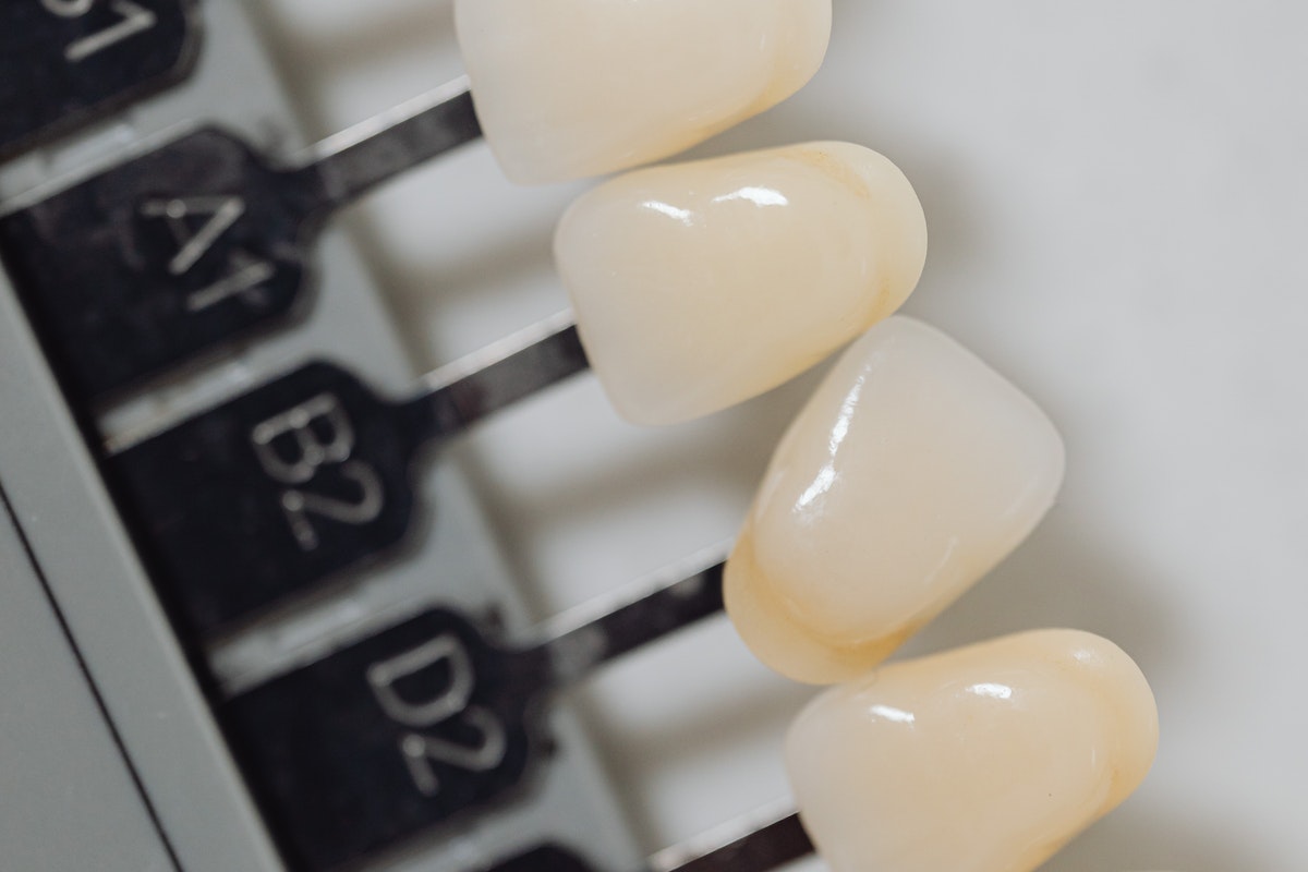 Porcelain veneers with your dentist Liverpool Man Without Country